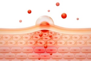 mild-antibacterial-and-anti-inflammatory-effects-01-1